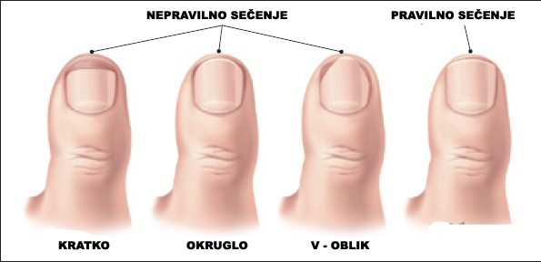 urasli-nokti-1