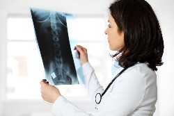 Female doctor looking at x-ray image on workplace.