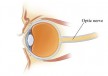 ocne-bolesti-cover